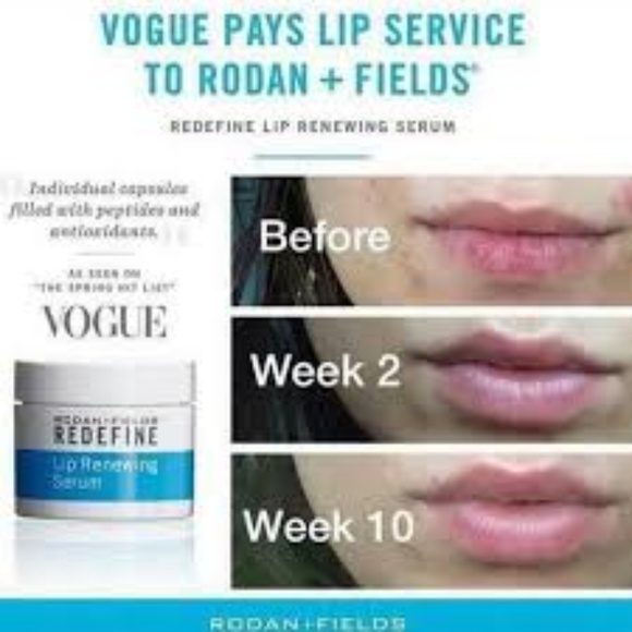Rodan + Fields Lip Renewing Serum - Picture 2 of 5